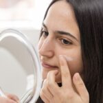 Best Acne Treatments — Your Complete Guide to Clearer Skin in 2026