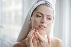 Top-Rated Acne Products in 2026 for Clear and Healthy Skin